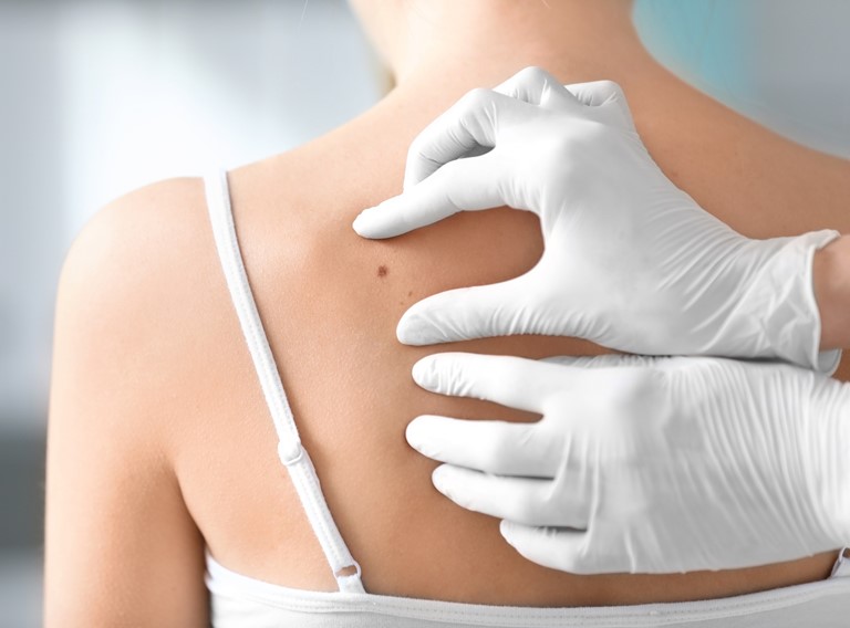 Consulta Dermatología