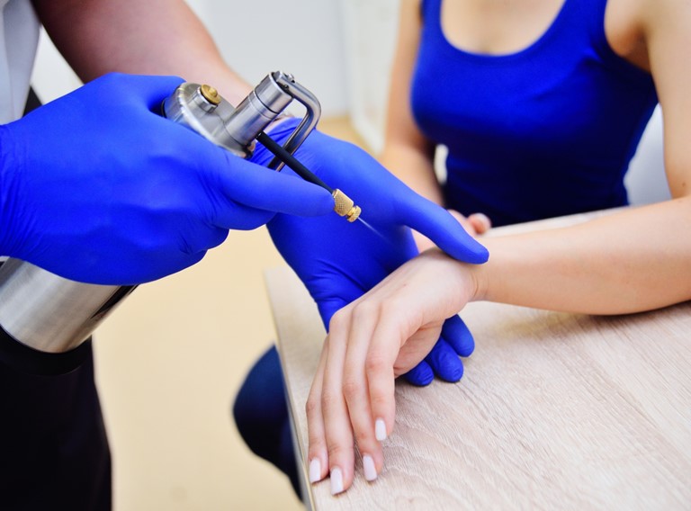 Electrocoagulación o Crioterapia de Verrugas, Tumores Superficiales, etc.