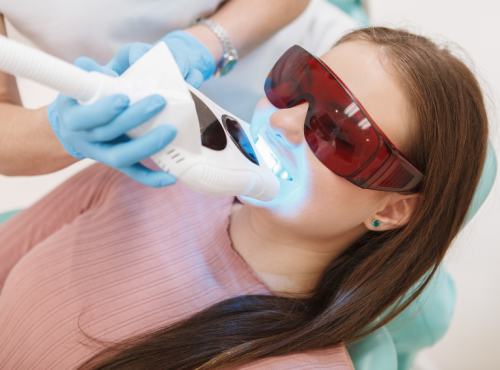 Blanqueamiento Dental por Fotoactivación