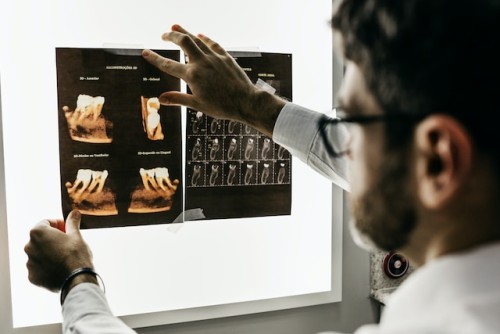 Endodoncia Multirradicular